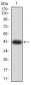Mouse Monoclonal Antibody to DDX58